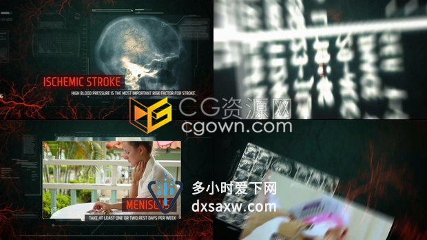 X射线高科技扫描静脉图像HUD元素动画镜头医疗健康医学宣传包装-AE模板